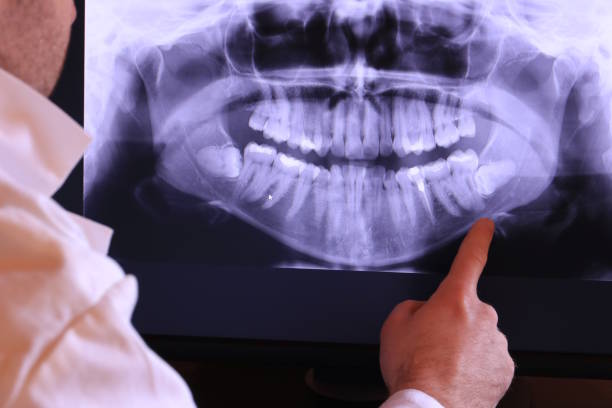 Best Emergency Wisdom Teeth Removal in Lamont, CA